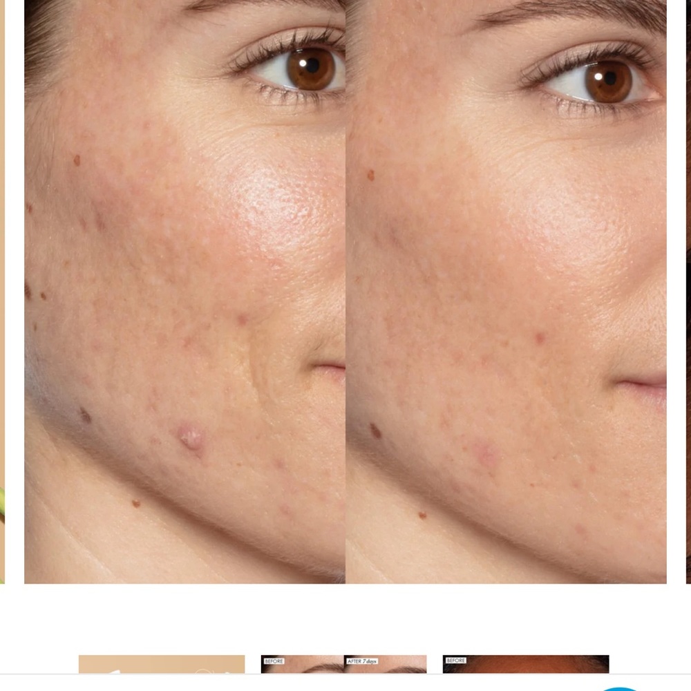Sunday Riley ~ ‘ALL-IN-ONE LACTIC ACID TREATMENT’ ~ FS ~> 1.0 oz./30 ml ~ NWOB - Picture 6 of 15